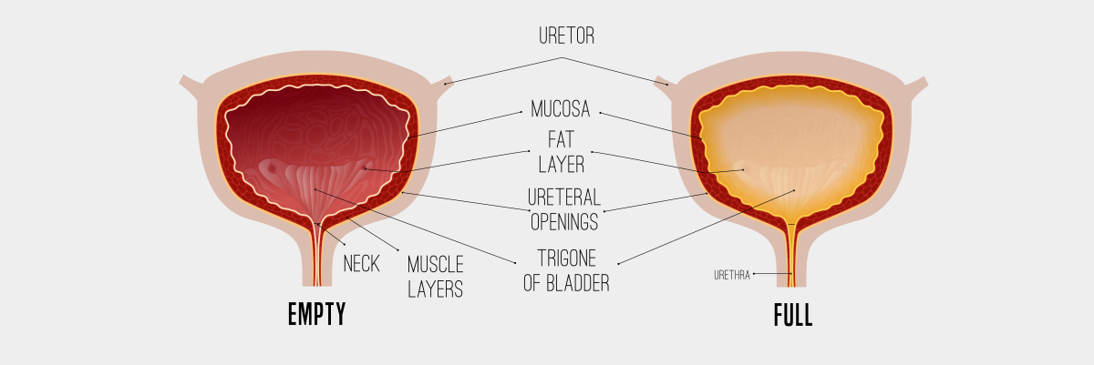 Empty bladder next to full bladder